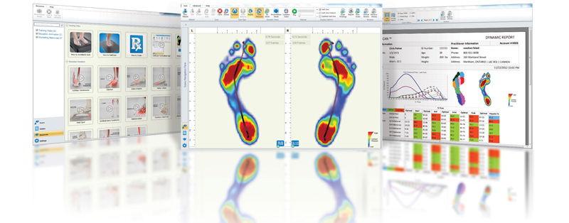 Gait analysis display